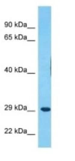 MDFI Rabbit anti-Human, Polyclonal, Novus Biologicals 100 μg; Unconjugated:Antibodies,
